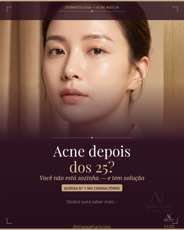 Capa do conteúdo sobre acne