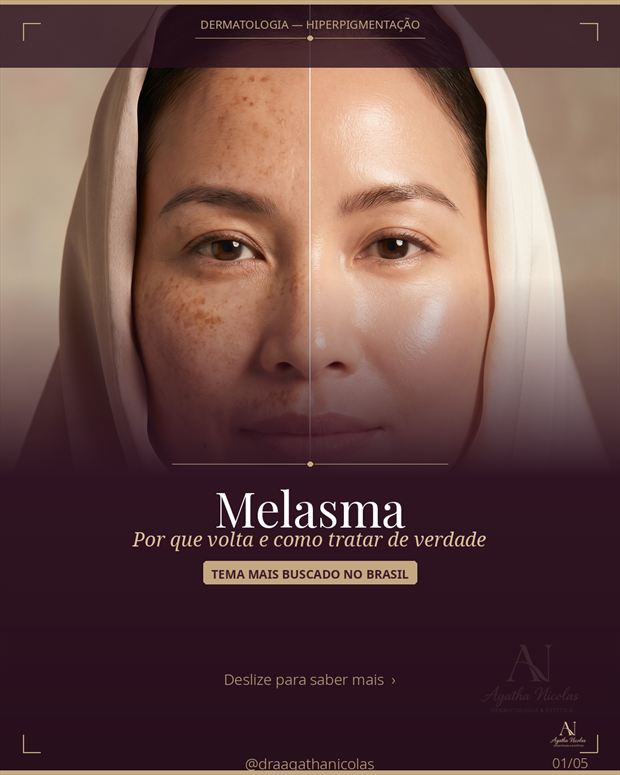 Capa do conteúdo sobre melasma