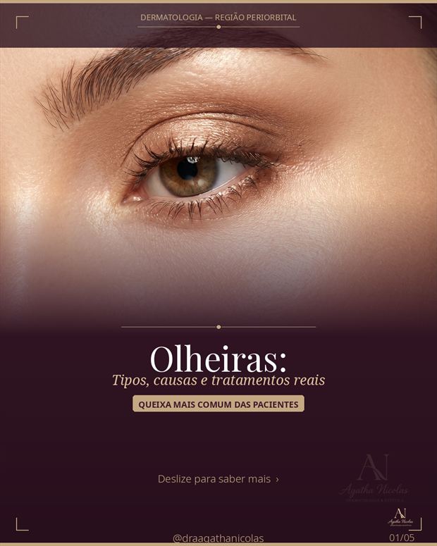 Capa do conteúdo sobre olheiras